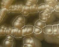 mycobacterium colonies mycobacterium colonies